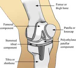 pelvic fracture surgery kolkata