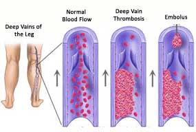 replacement surgery in kolkata