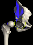 acetabular fracture surgery kolkata