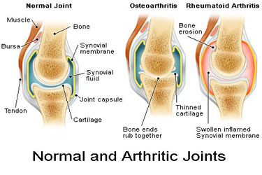 pelvic fracture surgery Kolkata