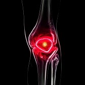 knee replacement in kolkata
