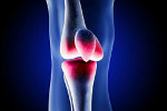 knee replacement surgery in kolkata