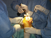 custom fit knee surgery kolkata